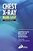 Chest X-Ray Made Easy