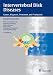 Intervertebral Disk Diseases: Causes, Diagnosis, Treatment... con Libri relativi al nominativo: 41EKjK6atRL._SL75_