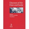 Diseases of the Hair and Scalp by R. P. R. Dawber