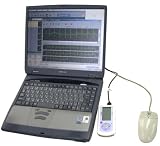 TOSHIBA ハートペット 心電図記憶装置 SCS-H20