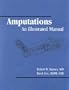 Amputations: An Illustrated Manual