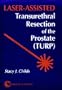 Laser-Assisted Transurethral Resection of the Prostate (Turp)