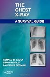 The Chest X-Ray: A Survival Guide, 1e