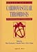 Books : Cardiovascular Thrombosis: Thrombocardiology and Thromboneurology