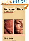 Sun-Damaged Skin
