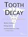 Book Tooth Decay - A Medical Dictionary, Bibliography, and Annotated Research Guide to Internet References
