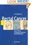 Rectal Cancer: New Frontiers in Diagnosis, Treatment and Rehabilitation