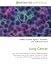 Lung Cancer: Lung, Non-small cell lung carcinoma, Adenocarcinoma, Metastasis, Lung cancer staging, Dyspnea, Clubbing, Carcinogen, Lambert-Eaton myasthenic syndrome, Health effects of tobacco