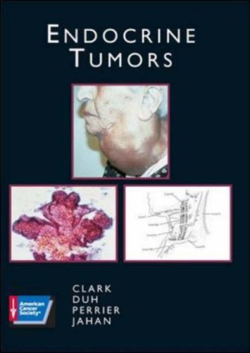 Endocrine-Diseases