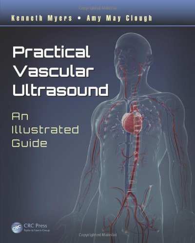 Practical Vascular Ultrasound: An Illustrated Guide 1st Edition by Myers, Kenneth, Clough, Amy May (2014) Paperback