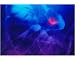Photographic Print of False-colour barium meal X-ray of duodenal ulcer from Science Photo Library