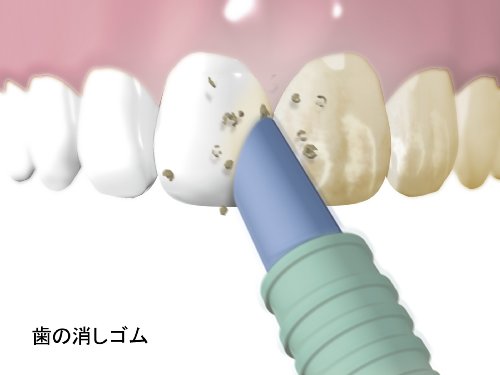 オーラル・ボーテ 電動デンタル&ビューティセット ピンク