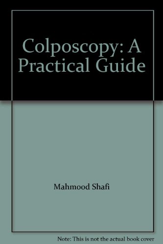 Colposcopy: A Practical Guide