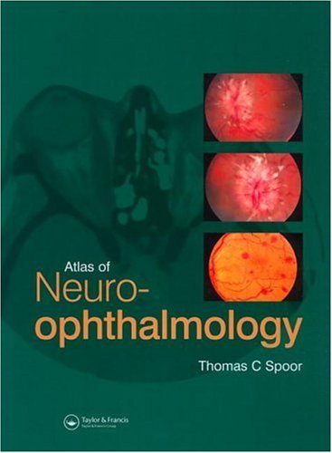Atlas of Neuro-Ophthalmology On Sale