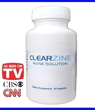 41Etq3JWlnL. SL160  Clearzine   The Top Rated Acne Treatment Pill. Eliminates Blotchiness, Redness, Blackheads and Zits