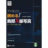 フェルソン読める胸部X線写真