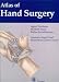 Books : Atlas of Hand Surgery