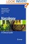 Narcolepsy: A Clinical Guide