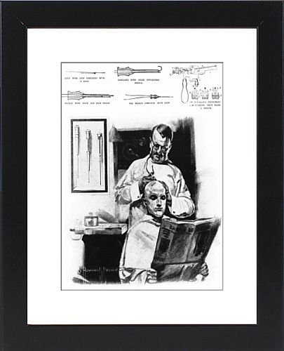 Framed Prints of Hair transplant from Mary Evans