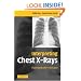 Interpreting Chest X-Rays: Illustrated with 100 Cases