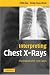 Interpreting Chest X-Rays: Illustrated with 100 Cases