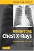 Interpreting Chest X-Rays: Illustrated with 100 Cases