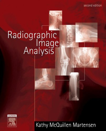 radiographic image analysis 2e