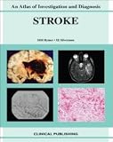 Ischemic Stroke: An Atlas of Investigation and Treatment (Atlases of Investigation and Management)