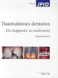 Traumatismes dentaires : Du diagnostic au traitement