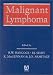 Book Malignant Lymphoma
