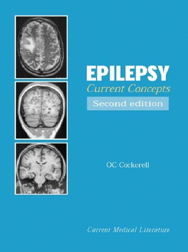 Epilepsy