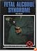 Fetal Alcohol Syndrome (Drug Abuse Prevention Library)