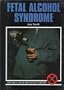 Fetal Alcohol Syndrome (Drug Abuse Prevention Library)