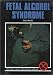 Book Fetal Alcohol Syndrome (Drug Abuse Prevention Library)