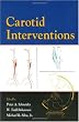 Carotid Interventions