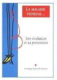 La maladie veineuse : Son �volution et sa pr�vention