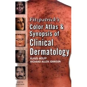 Click here to buy Fitzpatrick's Color Atlas and Synopsis of Clinical Dermatology: Sixth Edition... by Klaus Wolff and Richard Johnson.