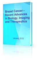 BREAST CANCER -RECENT ADVANCES IN BIOLOGY, IMAGING AND THERAPEUTICS-From Free Kindle Books Library Click to Download Free Kindle Book -> BREAST CANCER -RECENT ADVANCES IN BIOLOGY, IMAGING AND THERAPEUTICS
