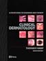 Clinical Dermatology: A Color Guide to Diagnosis and Therapy