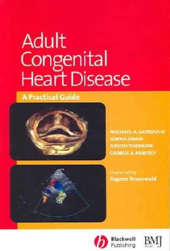 Congenital-Heart-Disease