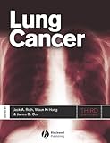 Lung cancer