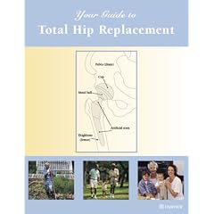Your Guide to Total Hip Replacement