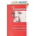 The Caesarean