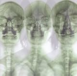 Supergrass