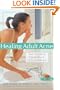 Healing Adult Acne: Your Guide to Clear Skin and Self-Confidence