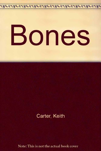 Bones