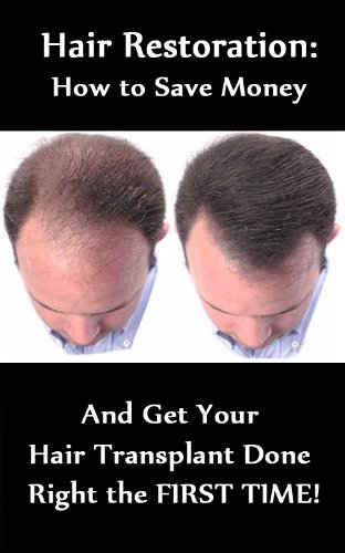 Hair Restoration - How to Save Money and Get Your Hair Transplant Done RIGHT the FIRST Time!