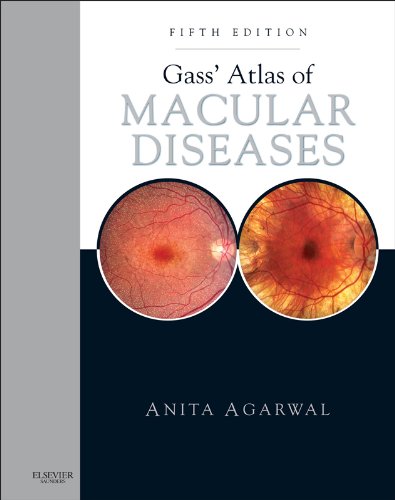 Gass' Atlas of Macular Diseases: 1-2