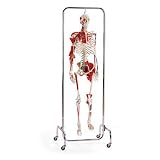 Laerdal Orthopedic Skeleton