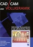 CAD/CAM und Vollkeramik: Wissenswertes für die alltägliche Praxis